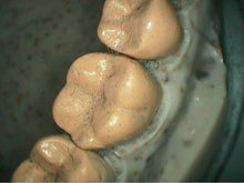 Load image into Gallery viewer, Claris i310 Dental High-Definition LED Intraoral Camera - SOLD AS-IS