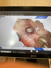 Load image into Gallery viewer, Sirona CEREC PrimeScan Connect Dental Intraoral Scanner for CAD/CAM Dentistry