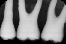 Load image into Gallery viewer, Gendex GXS-700 Dental Intraoral X-Ray Sensor Size 1 SOLD AS IS