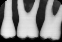 Load image into Gallery viewer, Gendex GXS-700 Dental Dentistry Digital Intraoral X-Ray Sensor Size 1