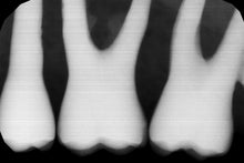 Load image into Gallery viewer, Gendex GXS-700 Dental Digital Intraoral X-Ray Sensor Size 1 Year: 2021