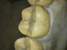 Load image into Gallery viewer, Air Techniques Cam-X Elara Dental High-Resolution Intraoral Camera