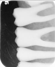 Load image into Gallery viewer, Air Techniques ScanX ILE Digital Imaging System Dental Phosphor Scanner