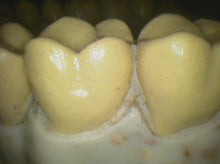 Load image into Gallery viewer, Air Techniques Cam-X Elara Dental Intraoral Camera Imaging System