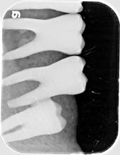 Load image into Gallery viewer, Air Techniques ScanX 2 IO Dental X-Ray Phosphor Plate Scanner