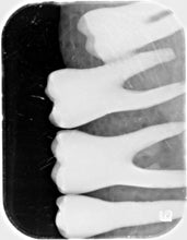 Load image into Gallery viewer, Air Techniques ScanX 2 IO Dental X-Ray Phosphor Plate Scanner