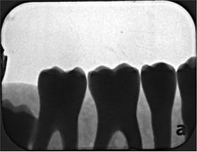 Load image into Gallery viewer, Air Techniques ScanX 2 Dental X-Ray Phosphor Plate Scanner