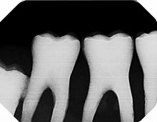 Load image into Gallery viewer, Dexis Platinum Dental Intraoral X-Ray Sensor Kit SOLD AS IS