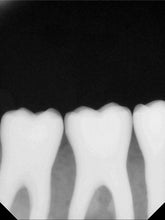 Load image into Gallery viewer, CareStream RVG 6100 Dental Intraoral X-Ray Sensor Size 2