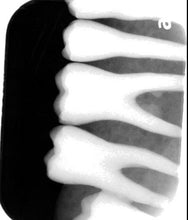 Load image into Gallery viewer, Air Techniques ScanX Swift Dental X-Ray Phosphor Plate Scanner