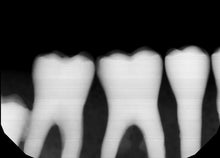 Load image into Gallery viewer, Gendex GXS-700 Dental Intraoral X-Ray Sensor Size 2 SOLD AS IS