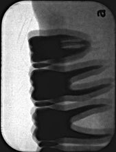 Load image into Gallery viewer, Air Techniques ScanX 2 Dental X-Ray Phosphor Plate Scanner
