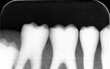 Load image into Gallery viewer, Acteon PSPIX 2 Dental X-Ray Phosphor Plate Scanner FOR PARTS