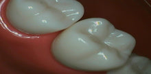 Load image into Gallery viewer, Digi Doc (Digital Doc) Iris (USB 2.0) Dental Intraoral Camera Imaging Unit