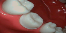 Load image into Gallery viewer, Digi Doc (Digital Doc) Iris (USB 2.0) Dental Intraoral Camera Imaging Apparatus