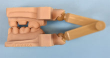 Load image into Gallery viewer, NEW UNUSED Planmeca Emerald S Dental Intraoral Scanner for CAD/CAM Dentistry