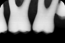 Load image into Gallery viewer, Gendex GXS-700 Dental Intraoral X-Ray Sensor Size 1 SOLD AS IS