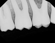 Load image into Gallery viewer, Dexis Titanium Dental Intraoral X-Ray Sensor Size 2