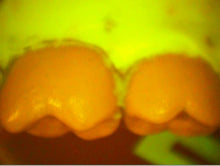 Load image into Gallery viewer, Lot of 3 Air Techniques Spectra Dental Intraoral Cameras Imaging Systems
