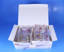 Load image into Gallery viewer, Milestone Scientific The Wand II Dental Local Anesthetic Delivery Device