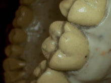 Load image into Gallery viewer, Digi Doc Iris (USB 2.0) Dental Intraoral Camera Imaging System