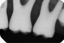 Load image into Gallery viewer, Gendex GXS-700 Dental Intraoral X-Ray Sensor Size 1