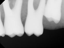 Load image into Gallery viewer, Carestream RVG 6100 Dental Intraoral X-Ray Sensor Size 2