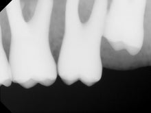 Load image into Gallery viewer, Carestream RVG 6100 Dental Intraoral X-Ray Sensor Size 2