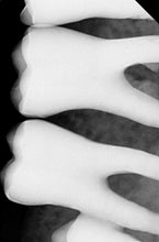 Load image into Gallery viewer, Vatech EzSensor HD 1.0 Dental Intraoral X-Ray Sensor 32 & 64 bit USB