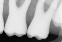 Load image into Gallery viewer, Sirona Schick 33 Dental Intraoral X-Ray Sensor Size 1 FOR PARTS