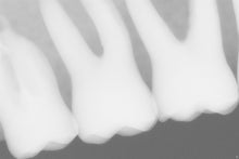 Load image into Gallery viewer, Sirona Schick 33 Dental Intraoral X-Ray Sensor Size 2