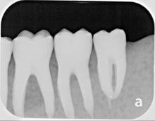 Load image into Gallery viewer, Air Techniques ScanX Duo Dental Digital Phosphor Plate X-Ray Scanner