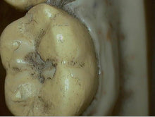 Load image into Gallery viewer, Digital Doc Iris (USB 2.0) Dental Intraoral Camera Imaging System