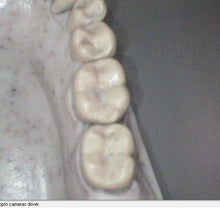 Load image into Gallery viewer, Acteon SOPROLIFE Intraoral Dental Camera Caries Detection Autofluorescence USB