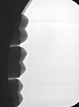 Load image into Gallery viewer, Air Techniques ScanX Intraoral View Digital PSP Dental X-Ray Scanner