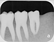 Load image into Gallery viewer, Air Techniques ScanX Duo Dental Digital Phosphor Plate X-Ray Scanner