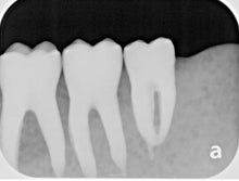 Load image into Gallery viewer, Air Techniques ScanX 2 IO Dental Phosphor Plate X-Ray Scanner