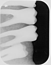 Load image into Gallery viewer, Air Techniques ScanX 2 IO Dental Phosphor Plate X-Ray Scanner