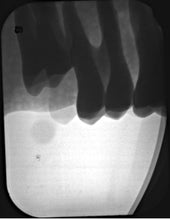 Load image into Gallery viewer, Air Techniques ScanX 2 IO Dental Phosphor Plate X-Ray Scanner