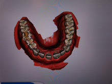 Load image into Gallery viewer, Sirona Primescan Connect Digital Dental Intraoral Scanner Laptop Kit