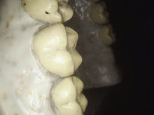 Load image into Gallery viewer, Carestream Kodak CS 1500 Intraoral Dental Camera Digital Imaging Wand - BROKEN