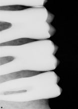 Load image into Gallery viewer, Dentsply Sirona Schick Elite 33 Digital Imaging Sensor Size 2 - Without Software