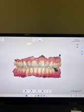 Load image into Gallery viewer, 3Shape Trios 5 Wireless Intraoral Dental Scanner w/ Laptop for CAD CAM