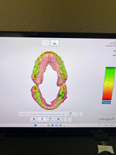 Load image into Gallery viewer, 3Shape Trios 5 Wireless Intraoral Dental Scanner w/ Laptop for CAD CAM
