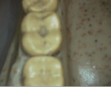 Load image into Gallery viewer, Digital Doc Iris USB 2.0 Dental Intraoral Camera Wand Imaging Unit