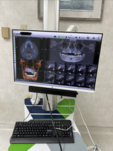 Load image into Gallery viewer, X-Guide X-Nav Dental Dynamic 3D Implant Navigation System