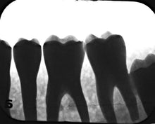 Load image into Gallery viewer, Air Techniques ScanX Classic Digital Dental Intraoral X-Ray Phosphor System