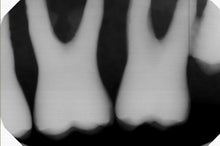 Load image into Gallery viewer, Gendex GXS-700 Dental Digital Sensor - SOLD AS-IS