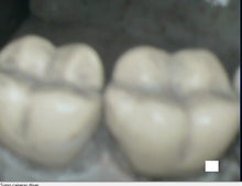 Load image into Gallery viewer, Acteon SoPro Care Dental Intraoral Camera Imaging System