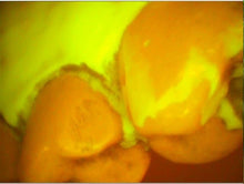 Load image into Gallery viewer, Lot of 3 Air Techniques Spectra Dental Intraoral Cameras Imaging Systems